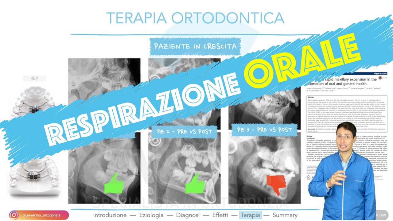 Respirazione orale (cause e terapia dei pazienti che respirano sempre a bocca aperta) - Lezione