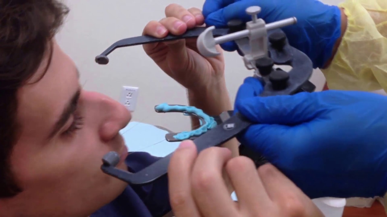Clinical Demonstration of How to Use a Facebow