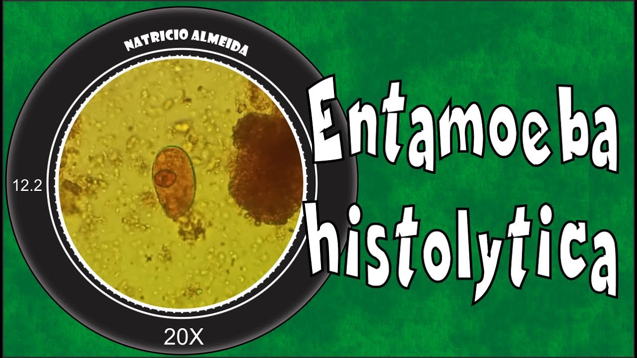 Entamoeba histolytica/dispar
