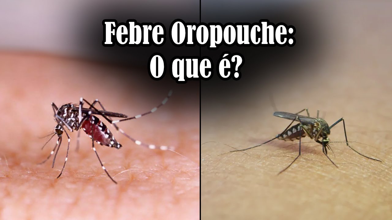 O que é a Febre Oropouche?