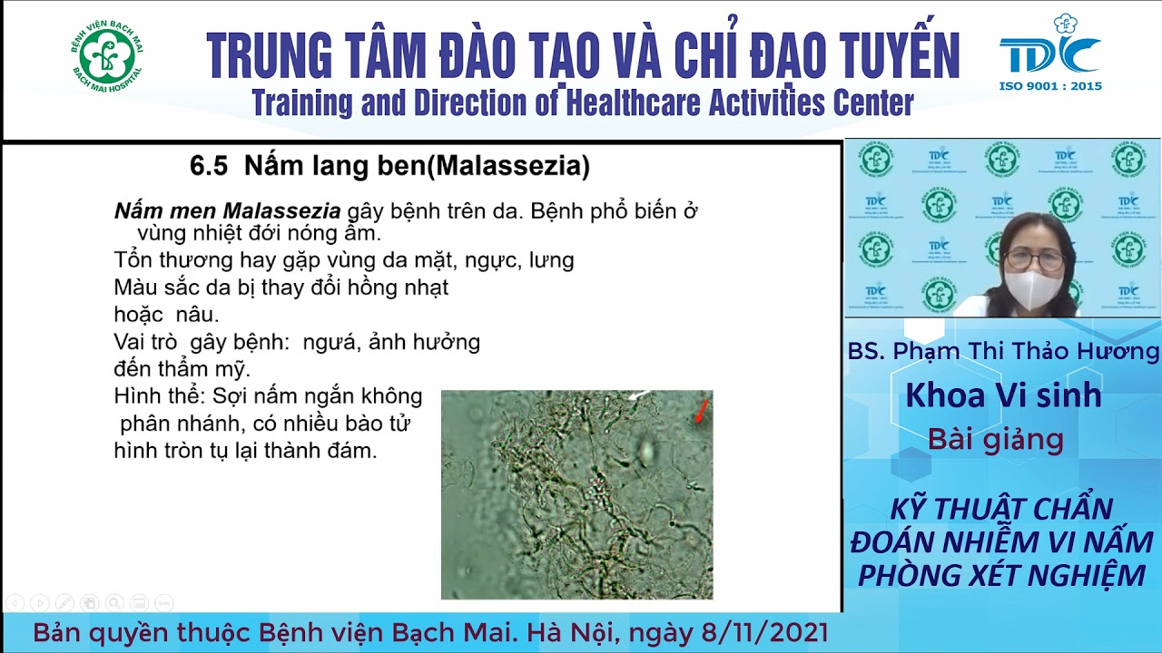 Kỹ thuật chẩn đoán nhiễm vi nấm phòng xét nghiệm