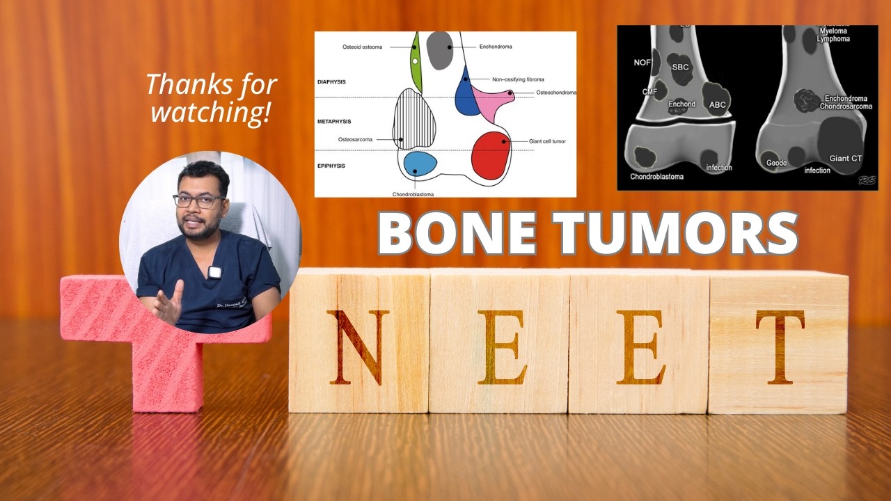 Bone Tumors: Must-Know Tables & Classifications