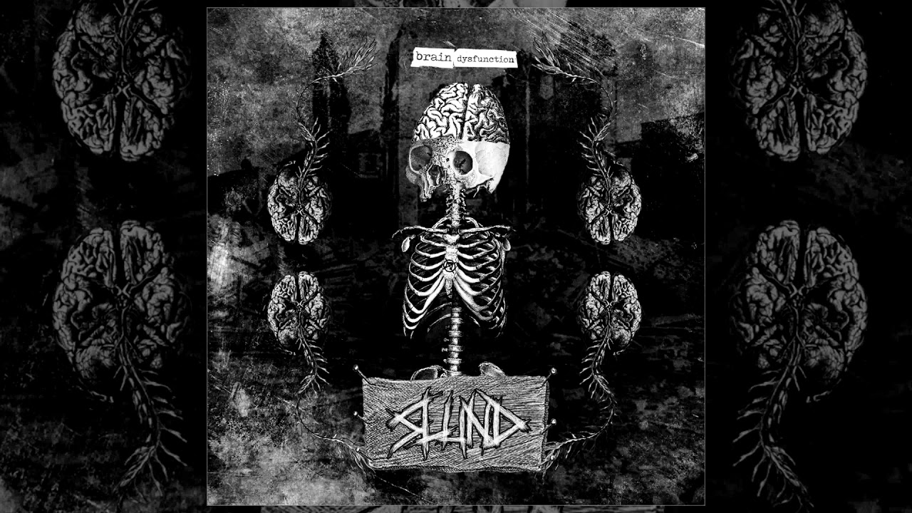 Slund - Brain Dysfunction 7