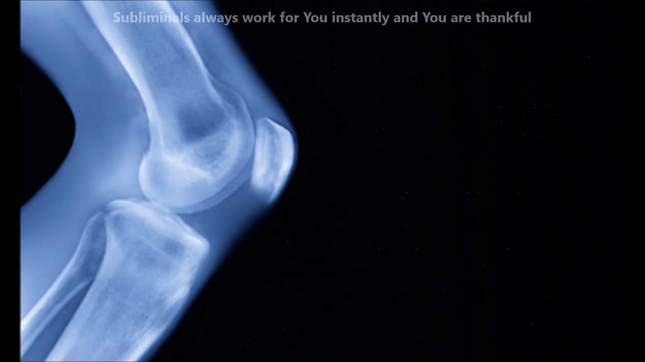 Healthy knees (REQUEST)