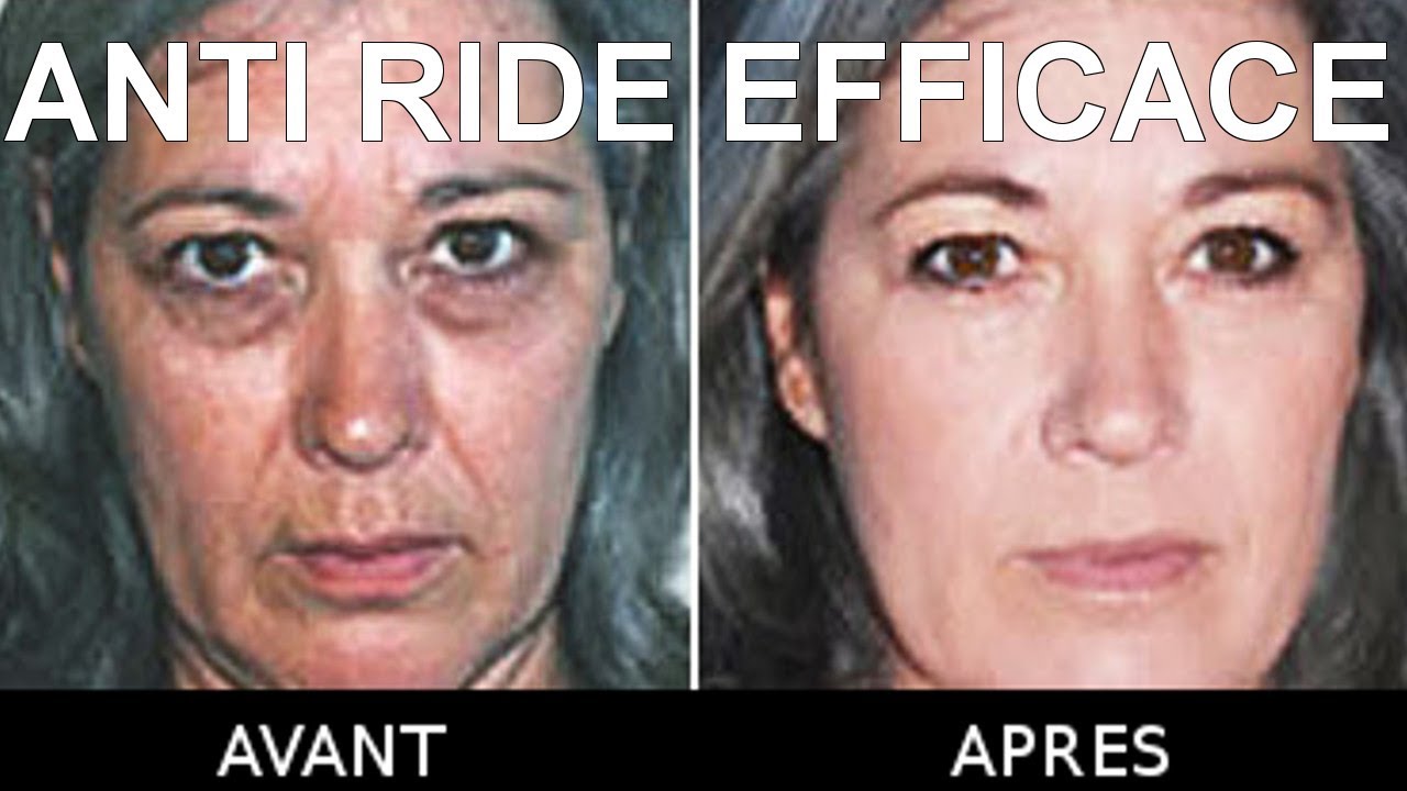 Anti Ride Efficace - Un Anti rides Pour Estomper Les Effets du Vieillissement