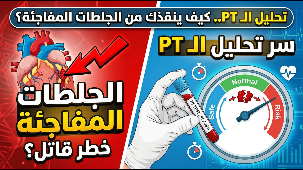 قراءة تحليل السيولة PT ومدي اهميته للكشف عن الجلطات
