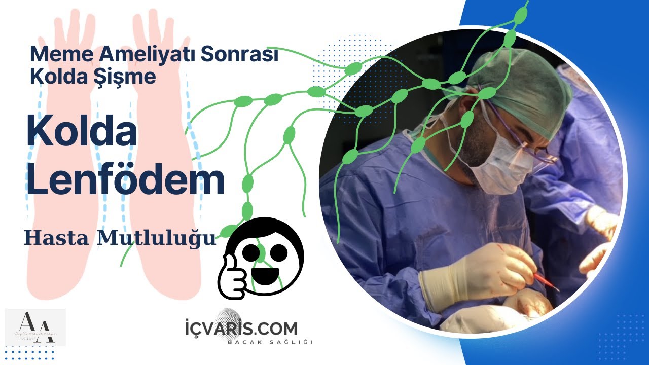 Meme Ameliyatı Sonrası Kol Lenfödemi Tedavisi | Hastalarımızın Mutlu Yorumları Prof. Dr. Ahmet Akgül