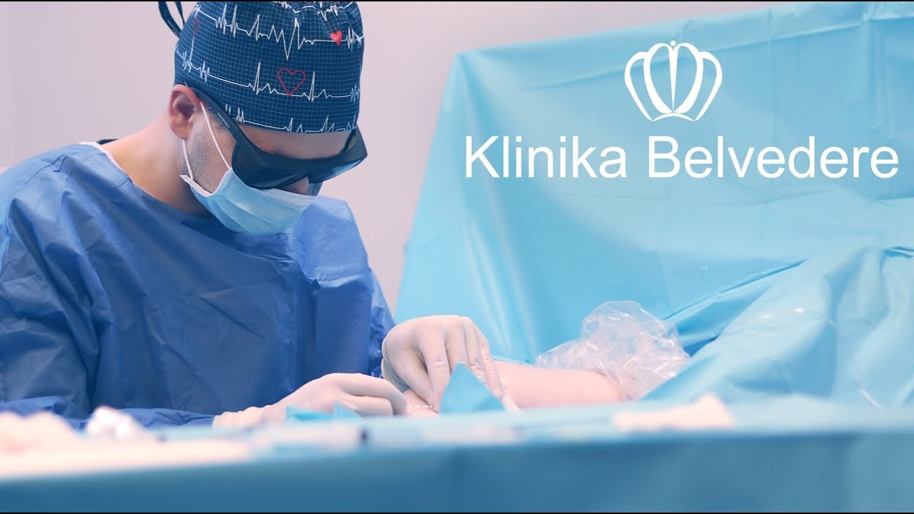 Laserowe usuwanie żylaków (Klinika Belvedere)
