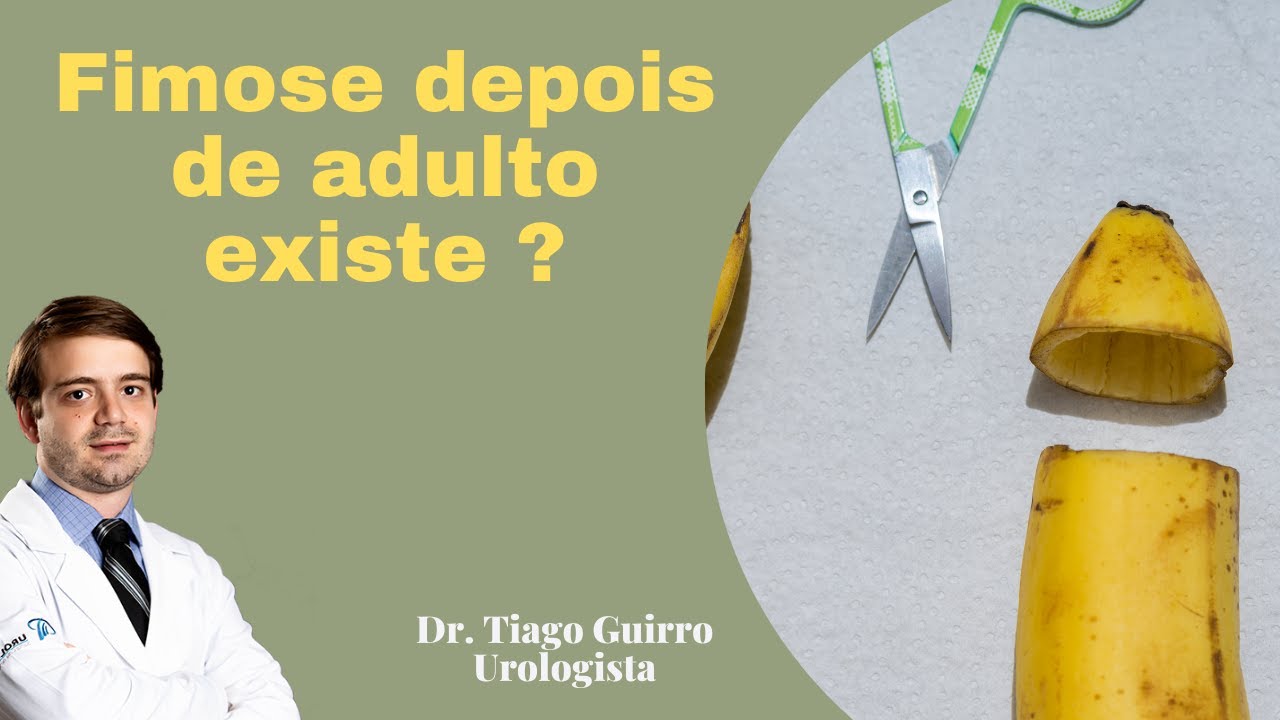 Existe fimose no adulto?