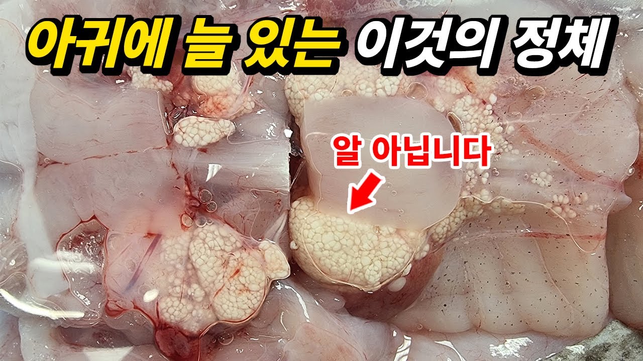지금까지 알인줄 알고 먹었는데 이게 전부 기생충?