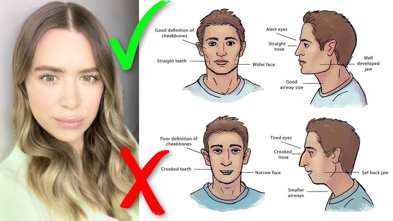 Negative Health + Dental Effects of MOUTH BREATHING