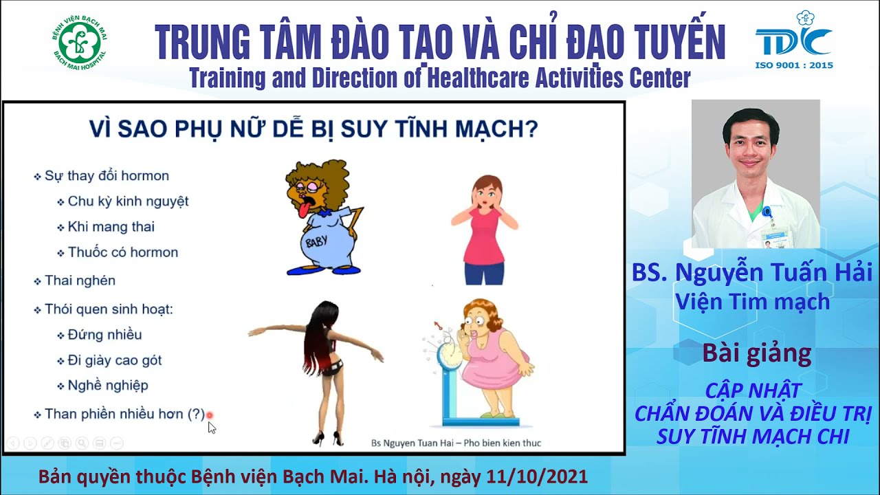 6. Cập nhật chẩn đoán suy tĩnh mạch chi