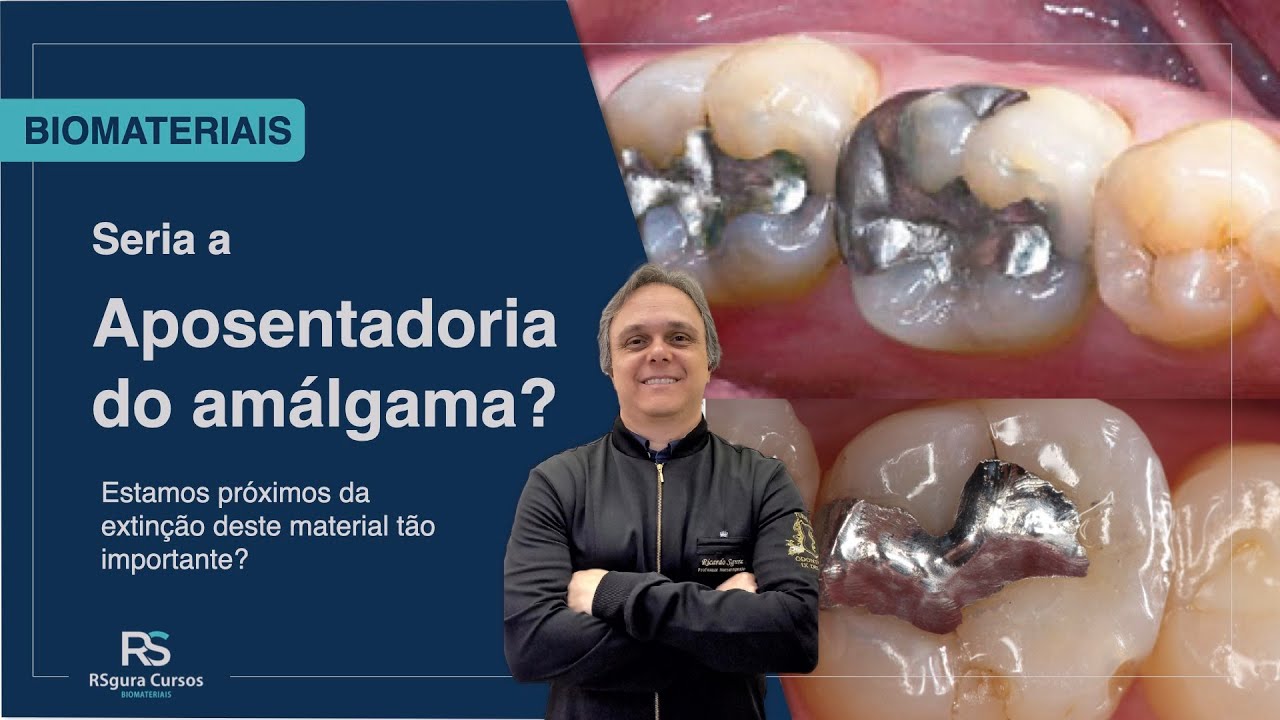 Estamos próximos da Aposentadoria do Amálgama?