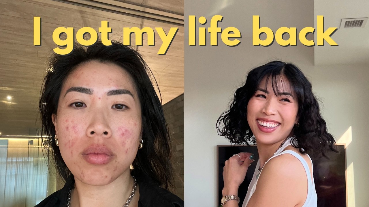 how I healed my burnout & acne with $94/week