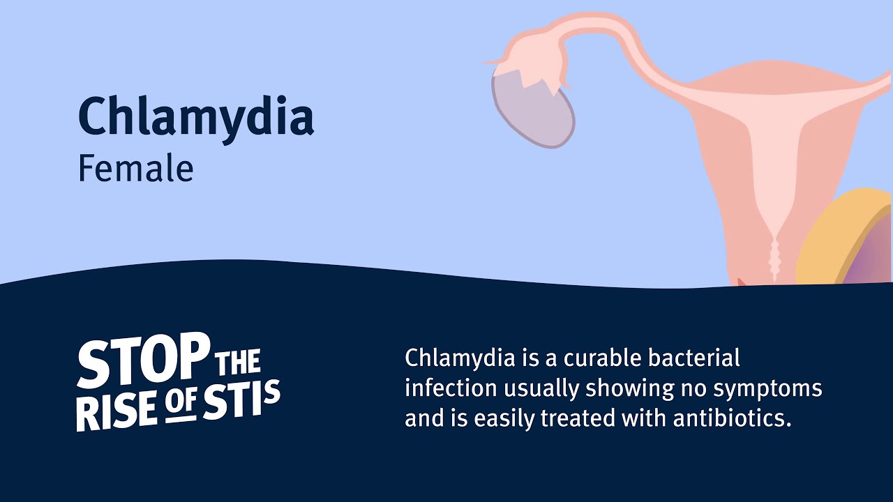 Sexual Health - Chlamydia (Female)