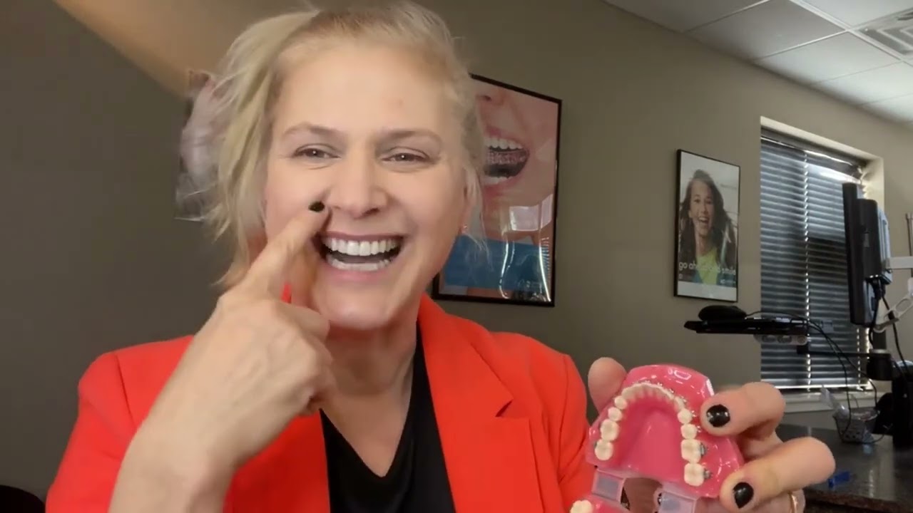 Palatal Expanders