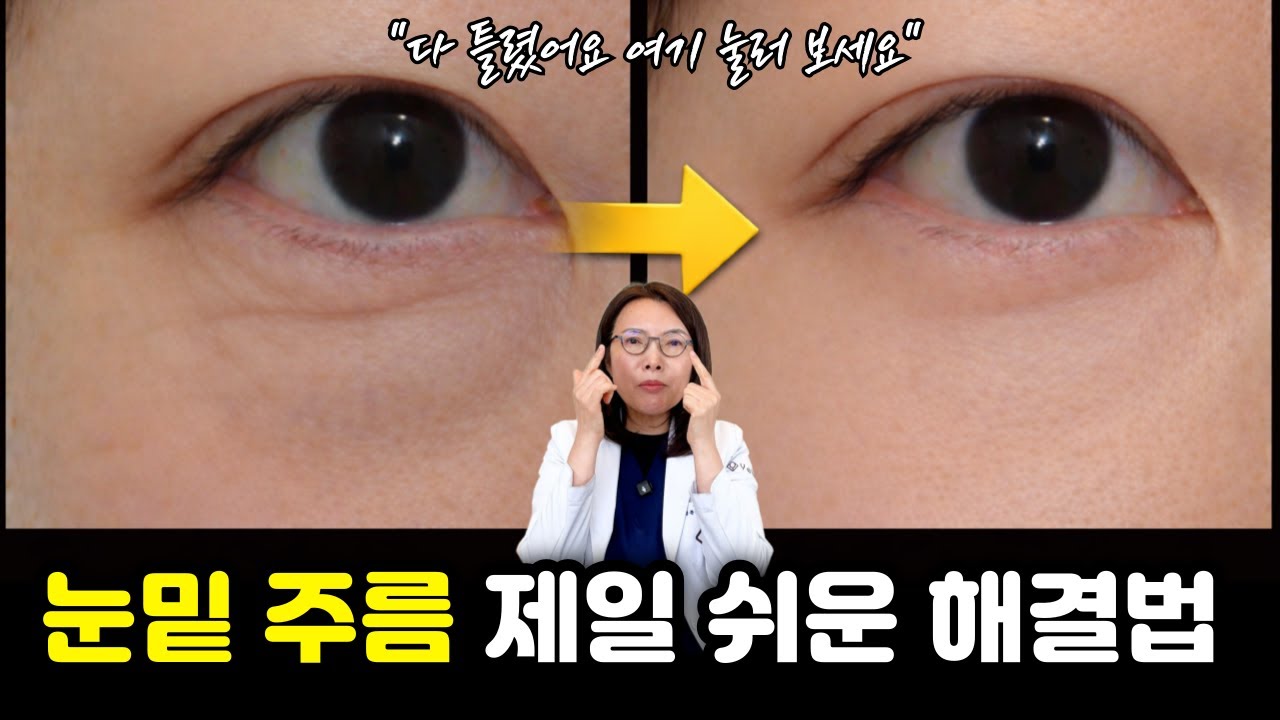눈밑 주름 마사지 99%는 잘못하고 있습니다. 집에서 이렇게 바꿔보세요.