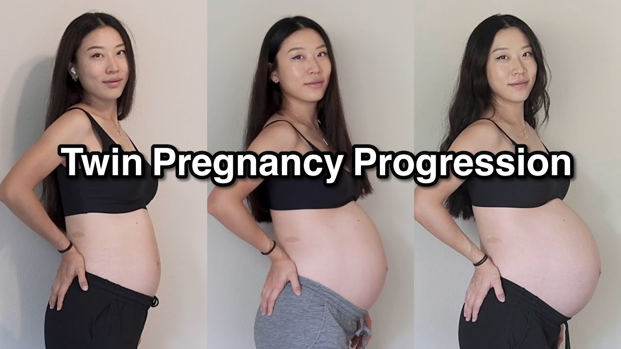 Twin Pregnancy Progression