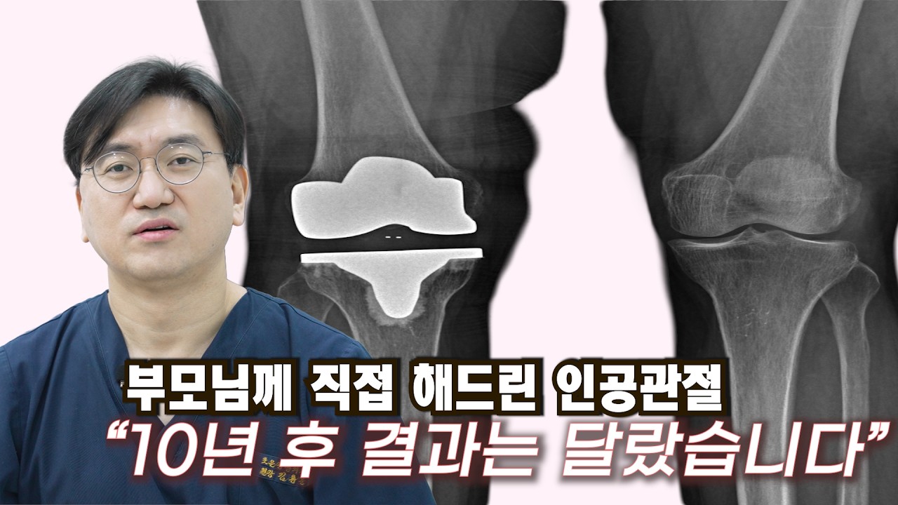 정형외과 의사가 부모님께 직접 해드린 인공관절– 해라 VS 하지 마라