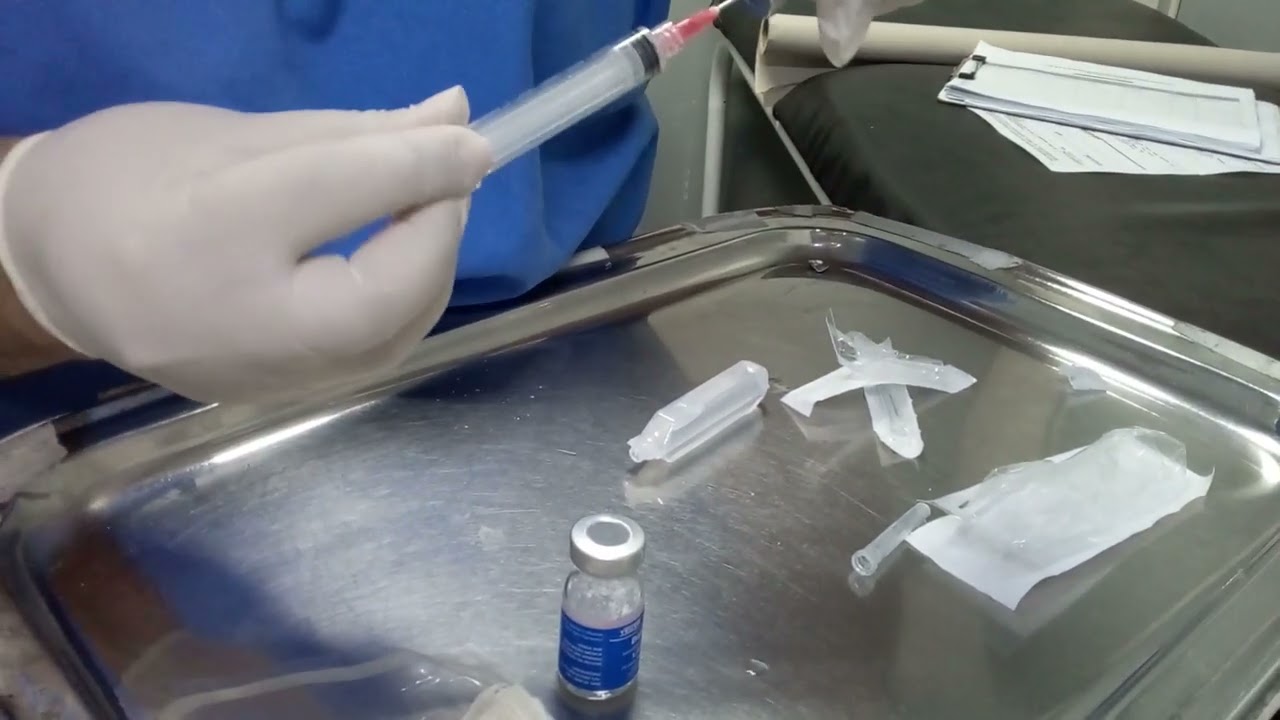 Reconstituição com lidocaína 2% 0,5ml com 4ml água destilada (AD):Penicilina G Benzatina. Benzetacil