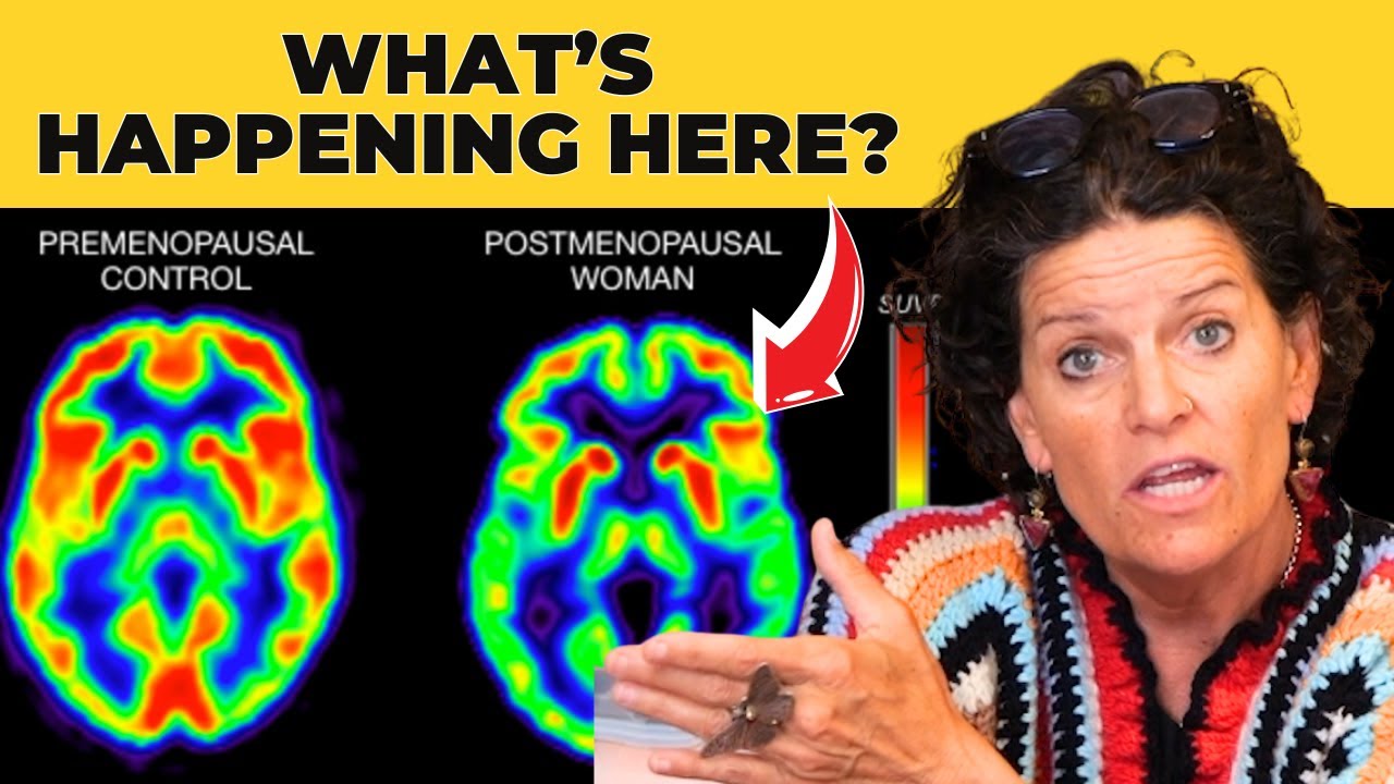 The 40+ Brain Remodel: What Every Woman Should Know | Dr. Mindy Pelz