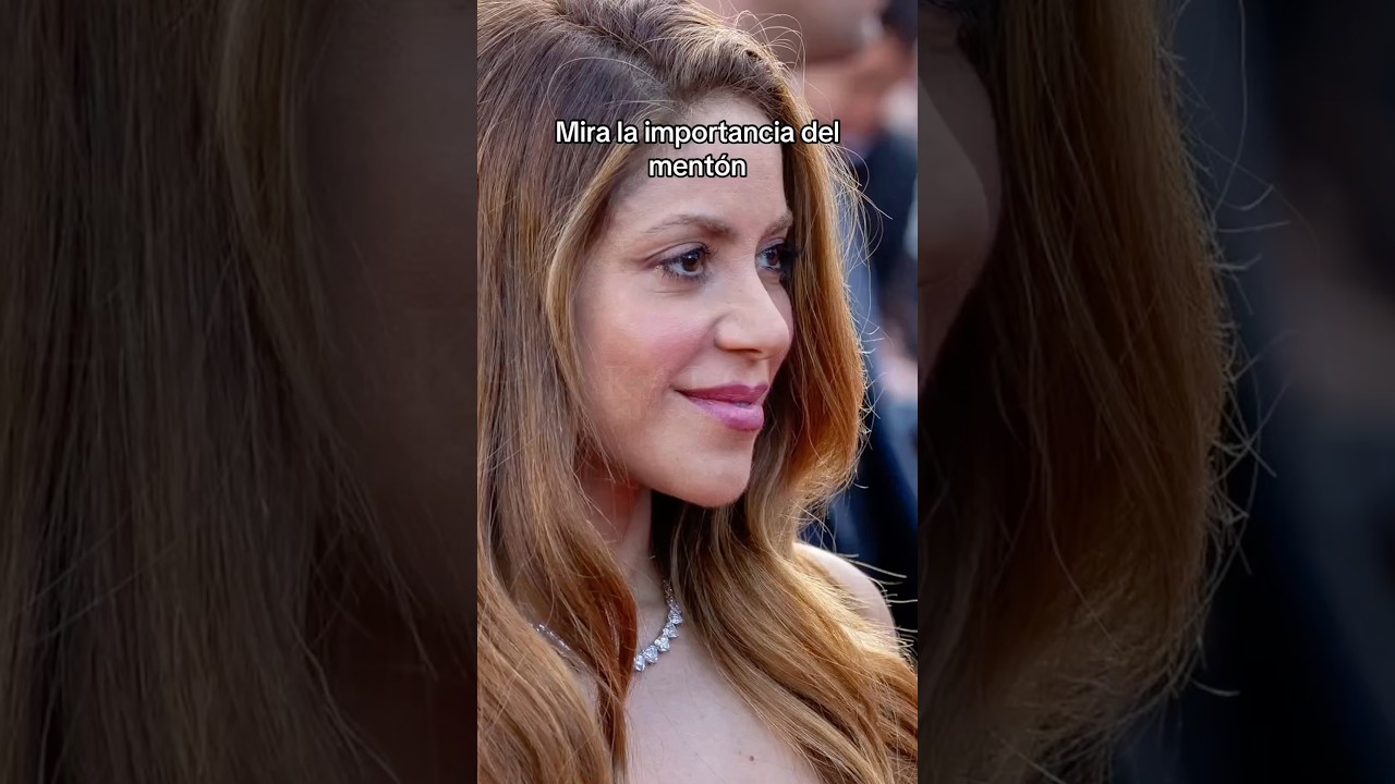 La importancia del ment&oacute;n en la simetr&iacute;a facial ✨.  #menton #belleza #celebrity #medicinaestetica