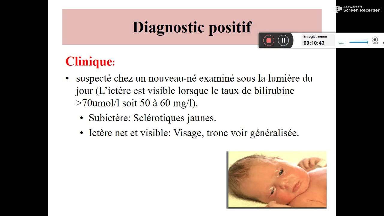 ICTERES NEONATAUX Dr DJEGHALI