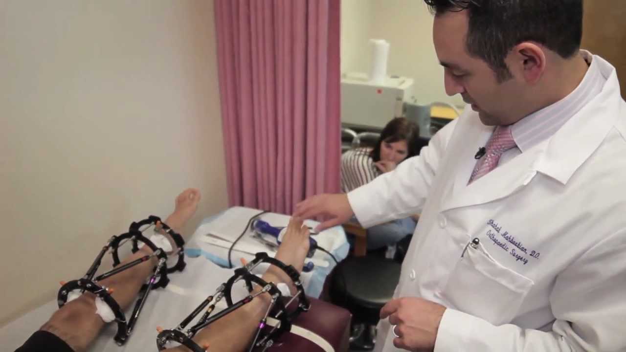 Height Lengthening Surgery With Dr. Shahab Mahboubian - Alex's Story Part II