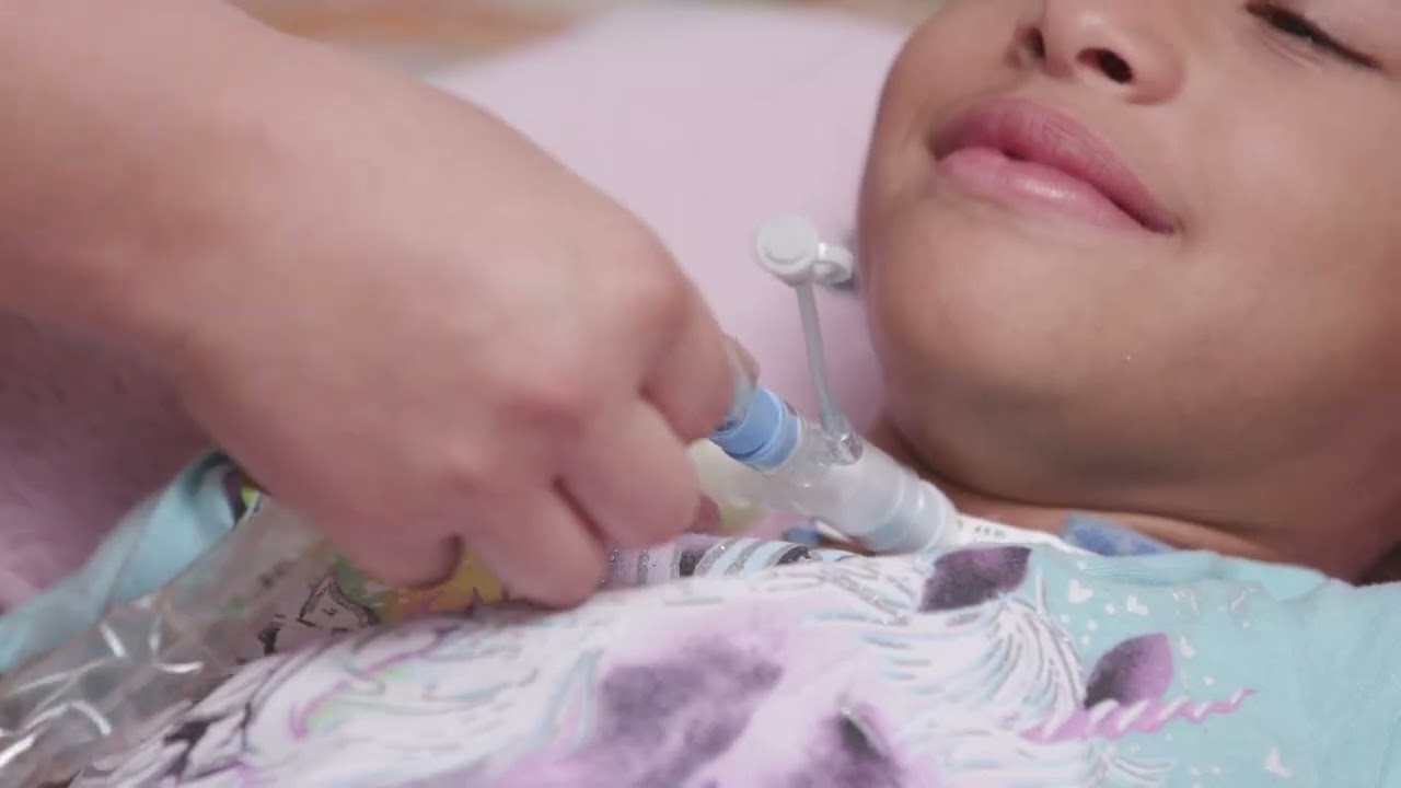 Inline Suctioning with a Tracheostomy Tube