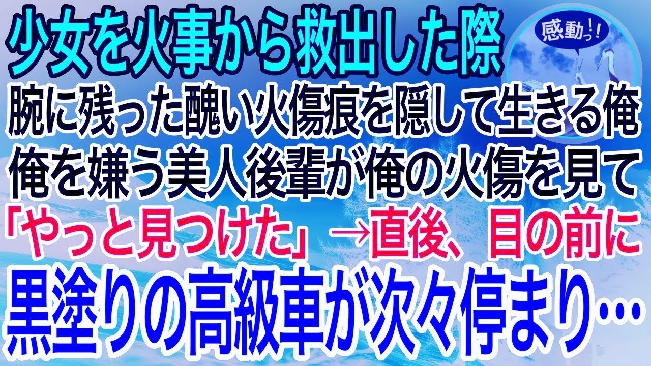 【感動】子供の時に火事現場から少女を救出。その時腕に残った醜い火傷の痕を隠して生きる俺。ある日、俺を嫌う美人後輩「その腕の火傷って…！？」→直後、目の前に黒塗りの高級車が次々停まり…【泣ける・良