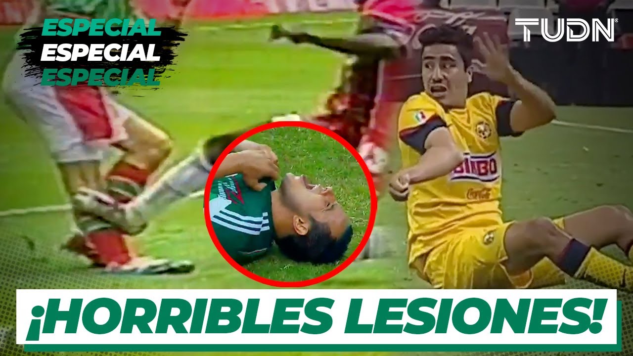 IMPACTANTE: &iexcl;Las lesiones m&aacute;s espeluznantes del futbol mexicano! | TUDN