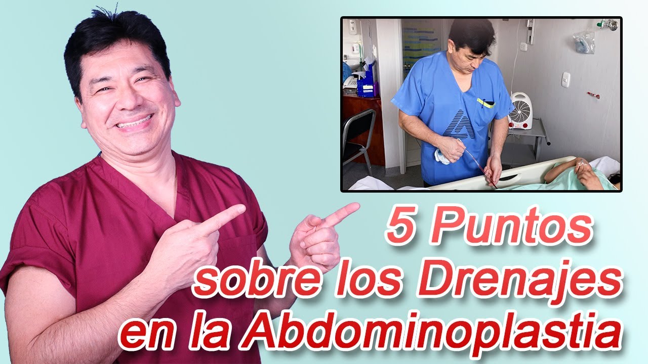 5 Puntos Clave Sobre El Uso de Drenajes en la Abdominoplastia