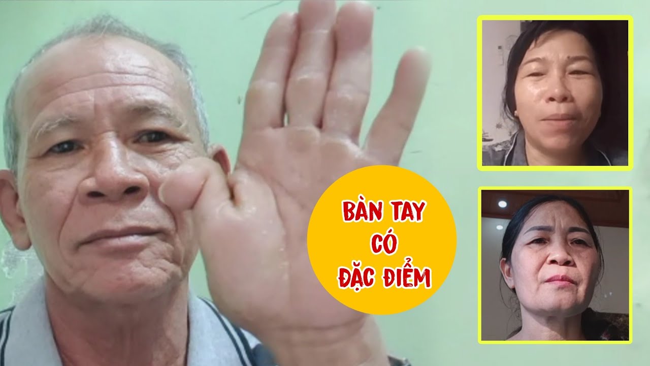 ( 248 ) Đặc điểm nhận biết là cái ngón tay. Mong đủ duyên gia đình nhận biết. Thêm 3 trường hợp...