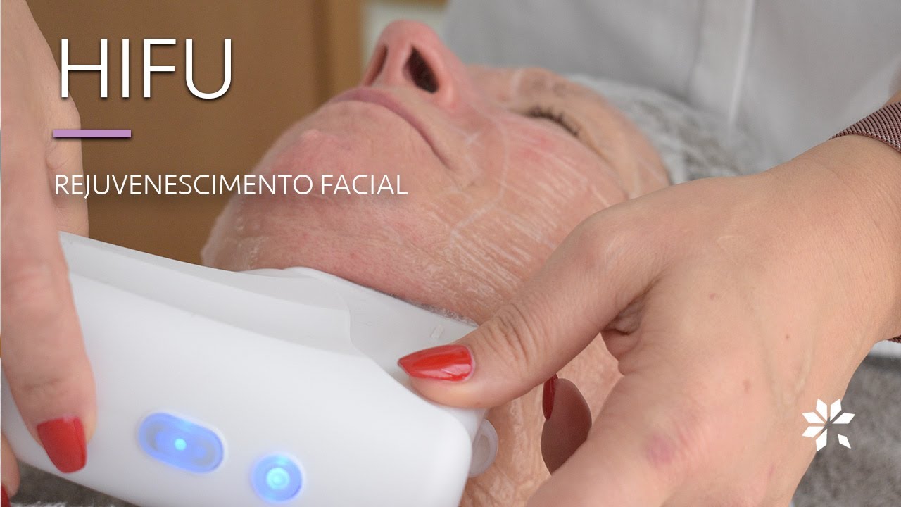 HIFU - Tratamento est&eacute;tico facial | Lisboa , Oeiras, Margem Sul, Entroncamento, Abrantes