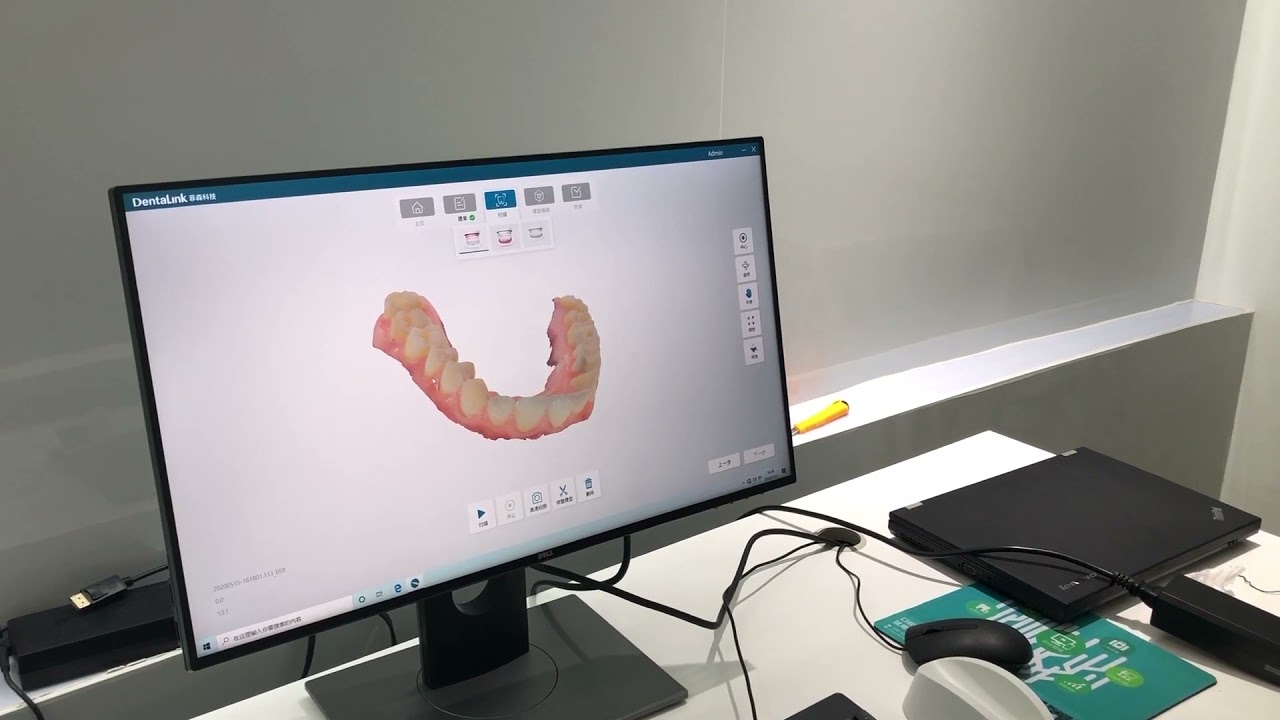 s6000 scanner intraoral fussen - Biotech ltda