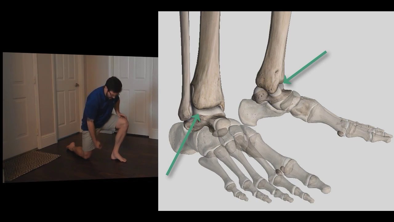 Education and common self treatments for high arches