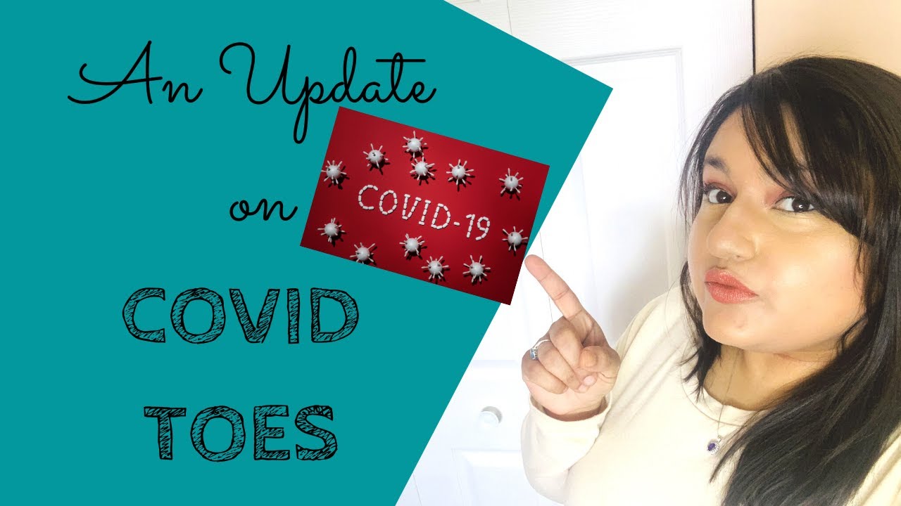 An Update on COVID TOES!