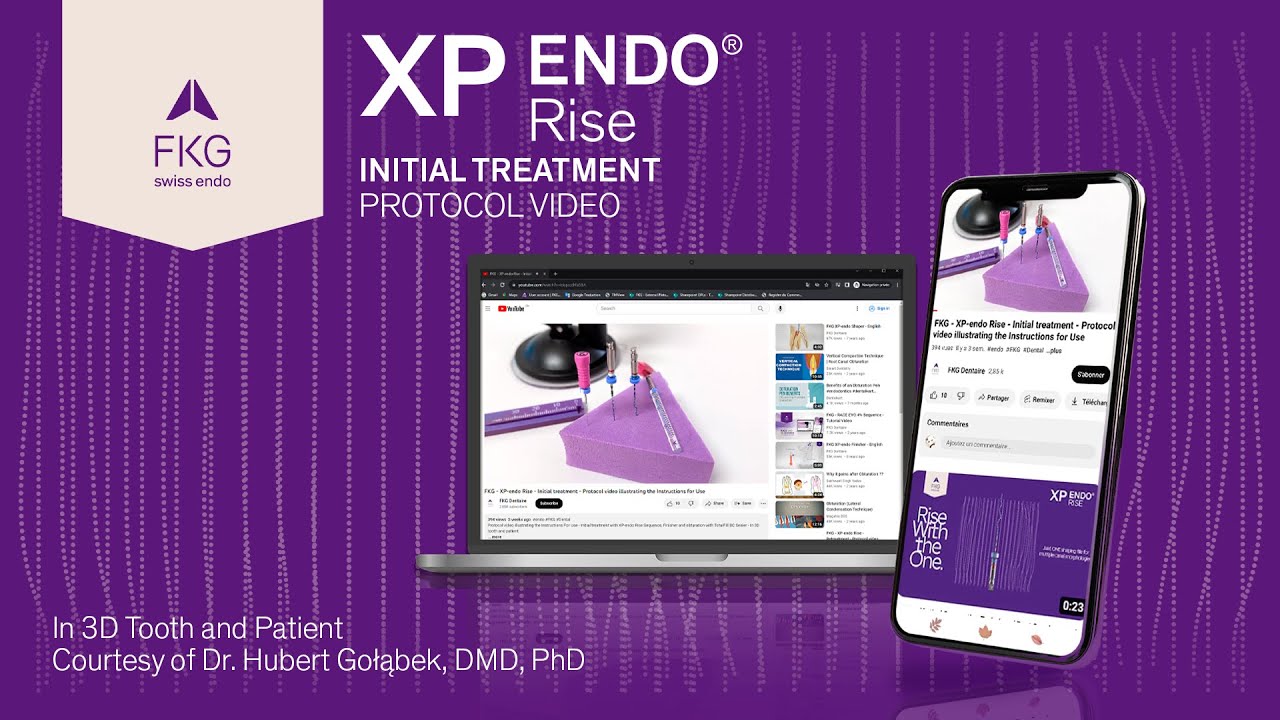 FKG - XP-endo Rise - Initial treatment - Protocol video illustrating the Instructions for Use