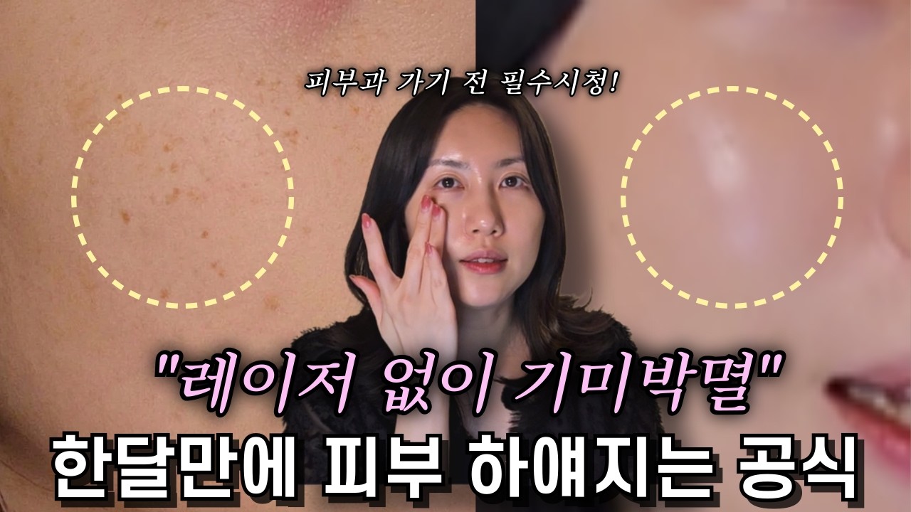 색소침착, 기미 생겨도 걱정 없는 이유,  한달 만에 피부가 하얘지는 비타민C 활용 공식