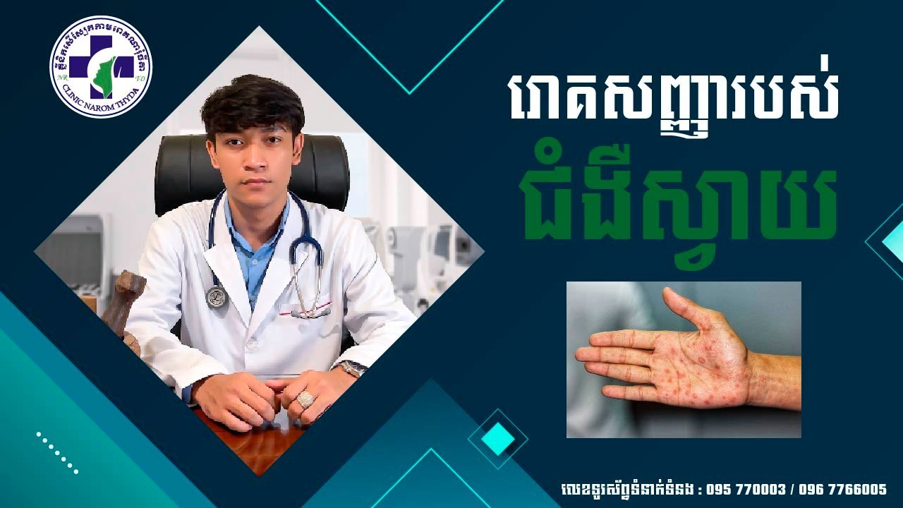 EP21 រោគសញ្ញារបស់ជំងឺស្វាយ (Syphilis Symptoms)