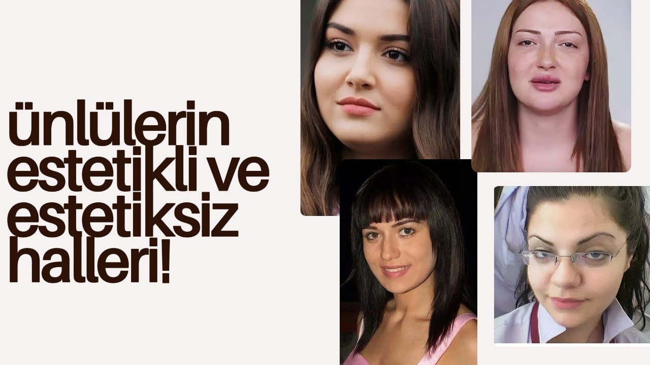 Чудо эстетики: Знаменитости до и после! 🧖‍♀️✨