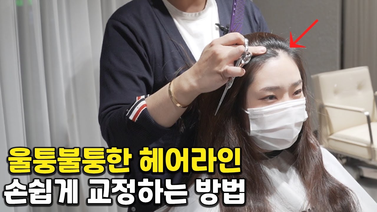 여자M자이마& 울퉁불퉁한 헤어라인,손쉽게 교정하는 방법