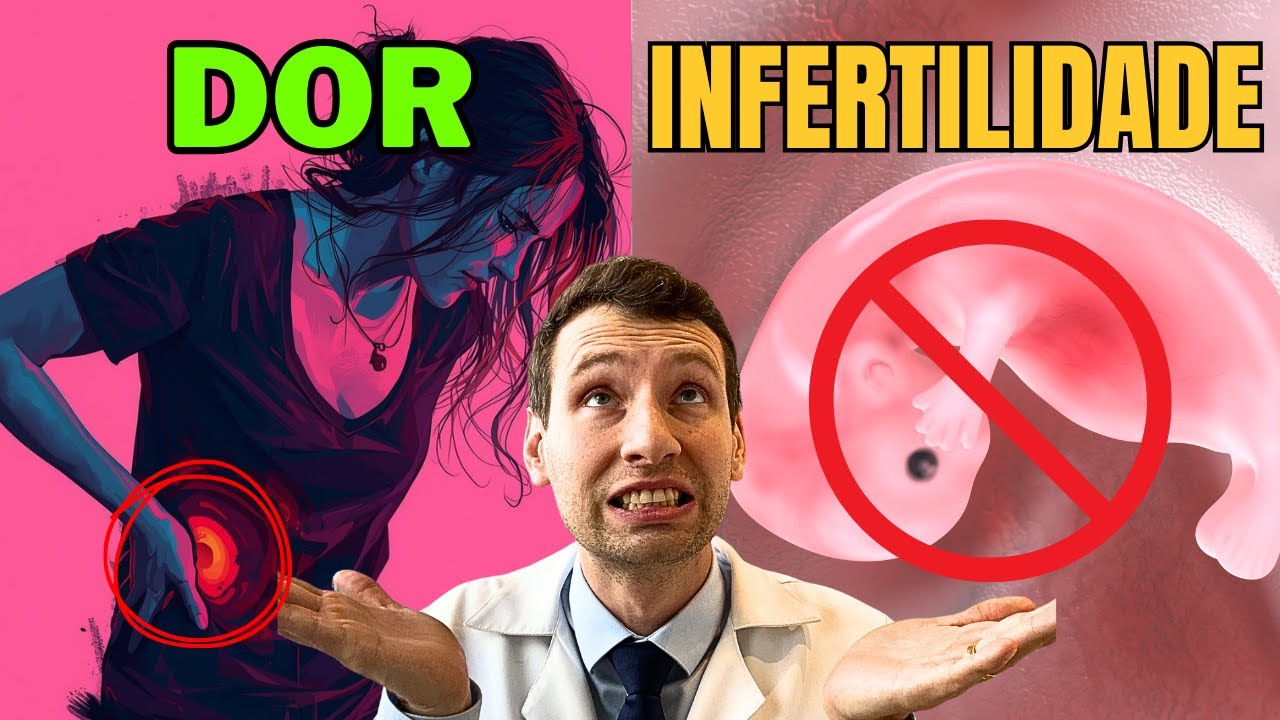 Endometriose: Causas, Sintomas, Tratamento e Consequências que TODA Mulher Precisa Saber