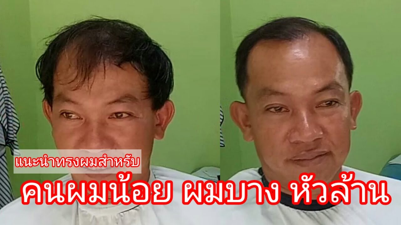 แนะนำทรงผมสำหรับคนหัวล้าน