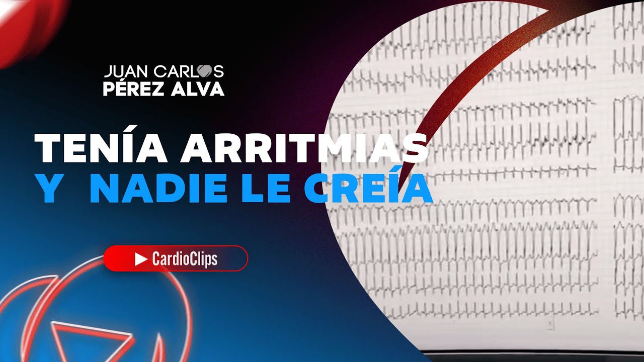 Tenía ARRITMIAS y NADIE LE CREÍA!!!