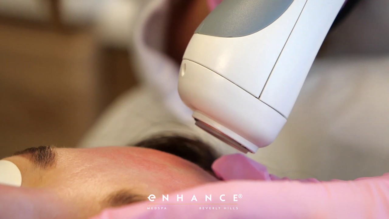 1540 Sublative Fractional Laser Treatment Beverly Hills