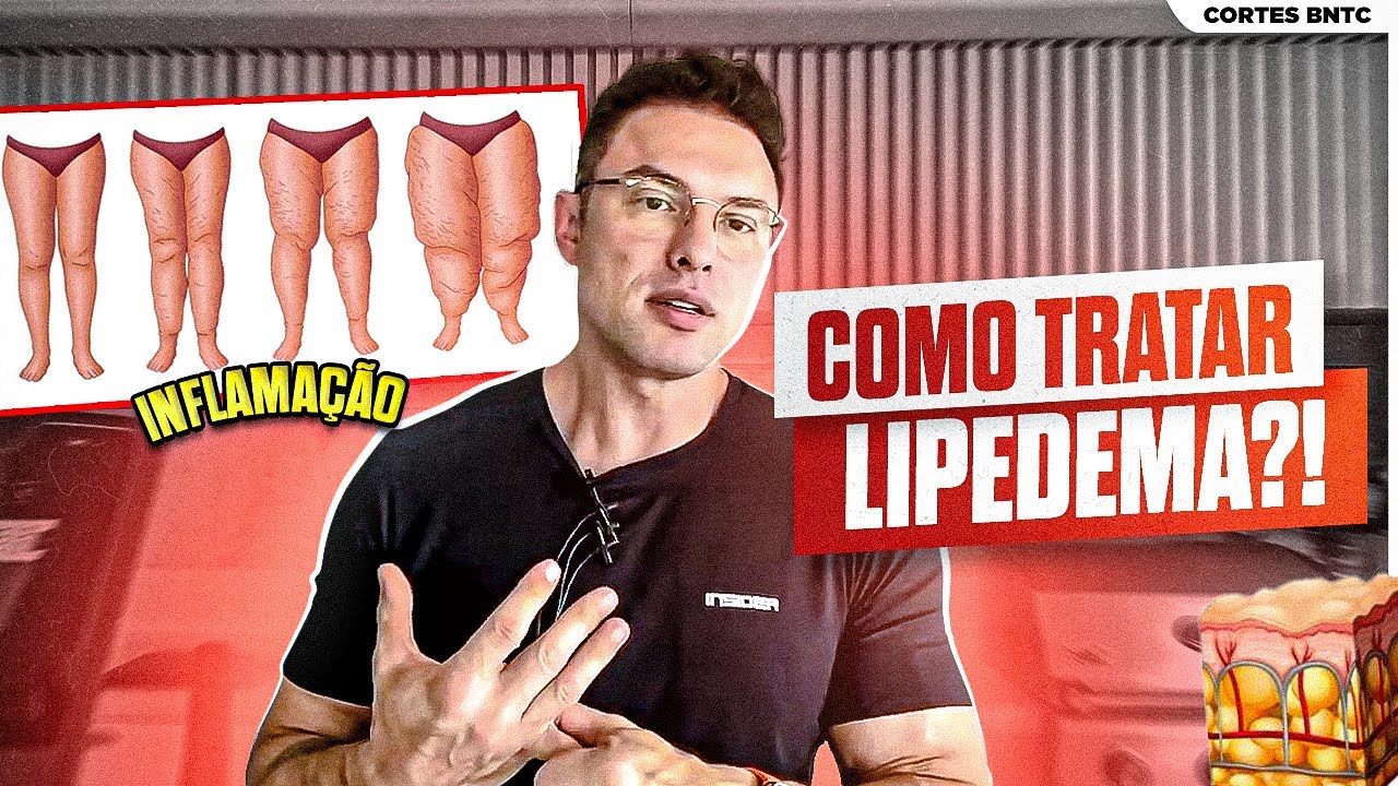 LIPEDEMA: O que é e COMO TRATAR?! | Muzy Explica