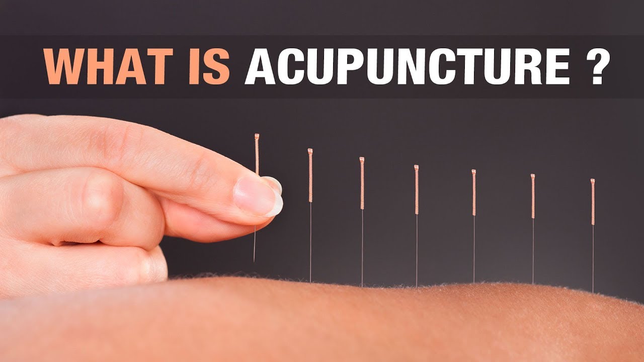 What is Acupuncture? - Dr. Mayie Deshmukh - Holistic Acupuncture