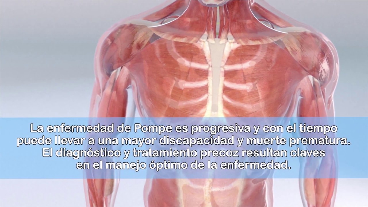 Vídeo diagnóstico Enfermedad de Pompe