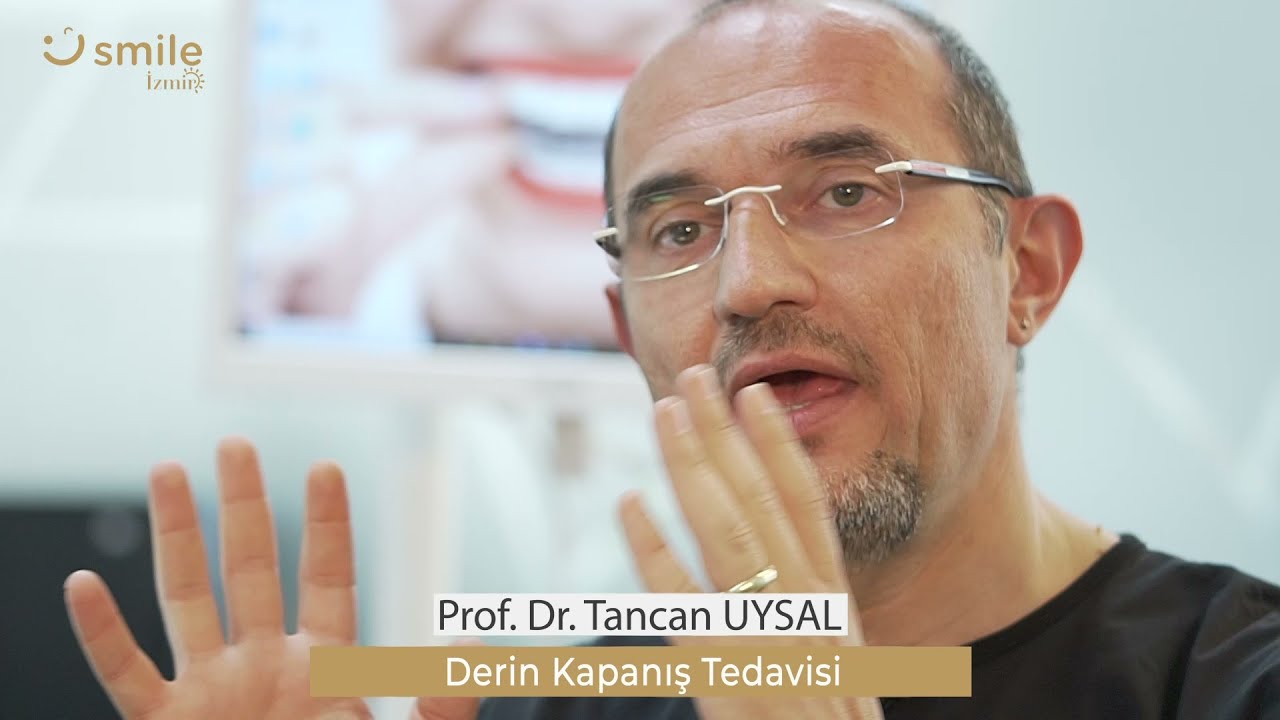 Derin Kapanış - Örtülü Kapanış (Deep Bite) Nedir? Şeffaf Plaklarla Tedavi Edilebilir mi?